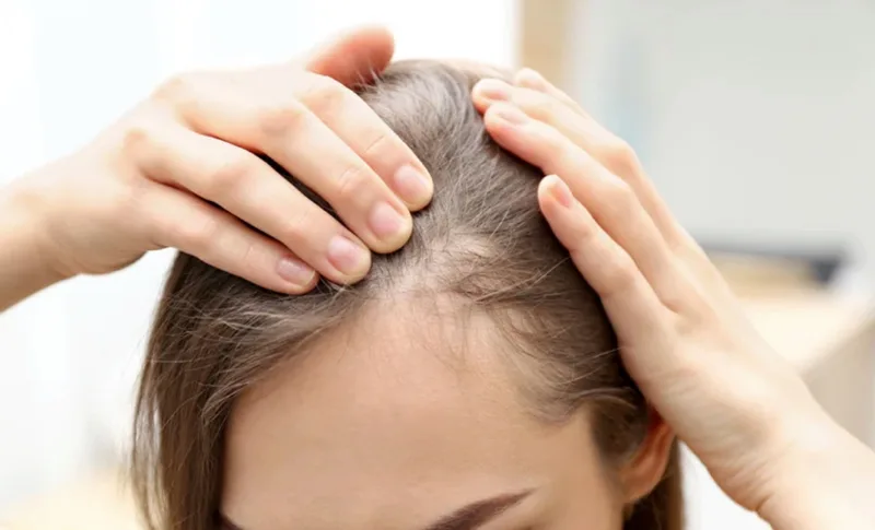 Service photo showing a close-up scalp assessment